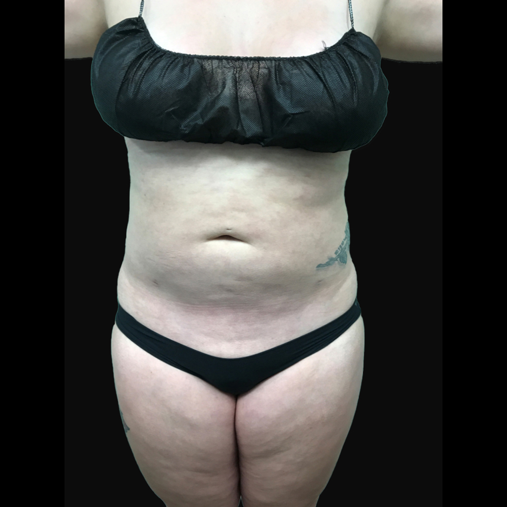 Bodytite Font View After
