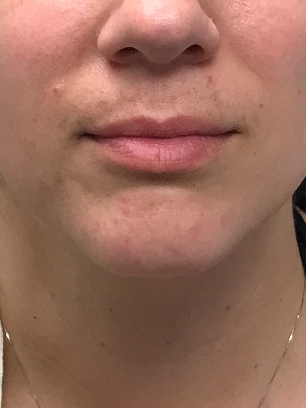 Before