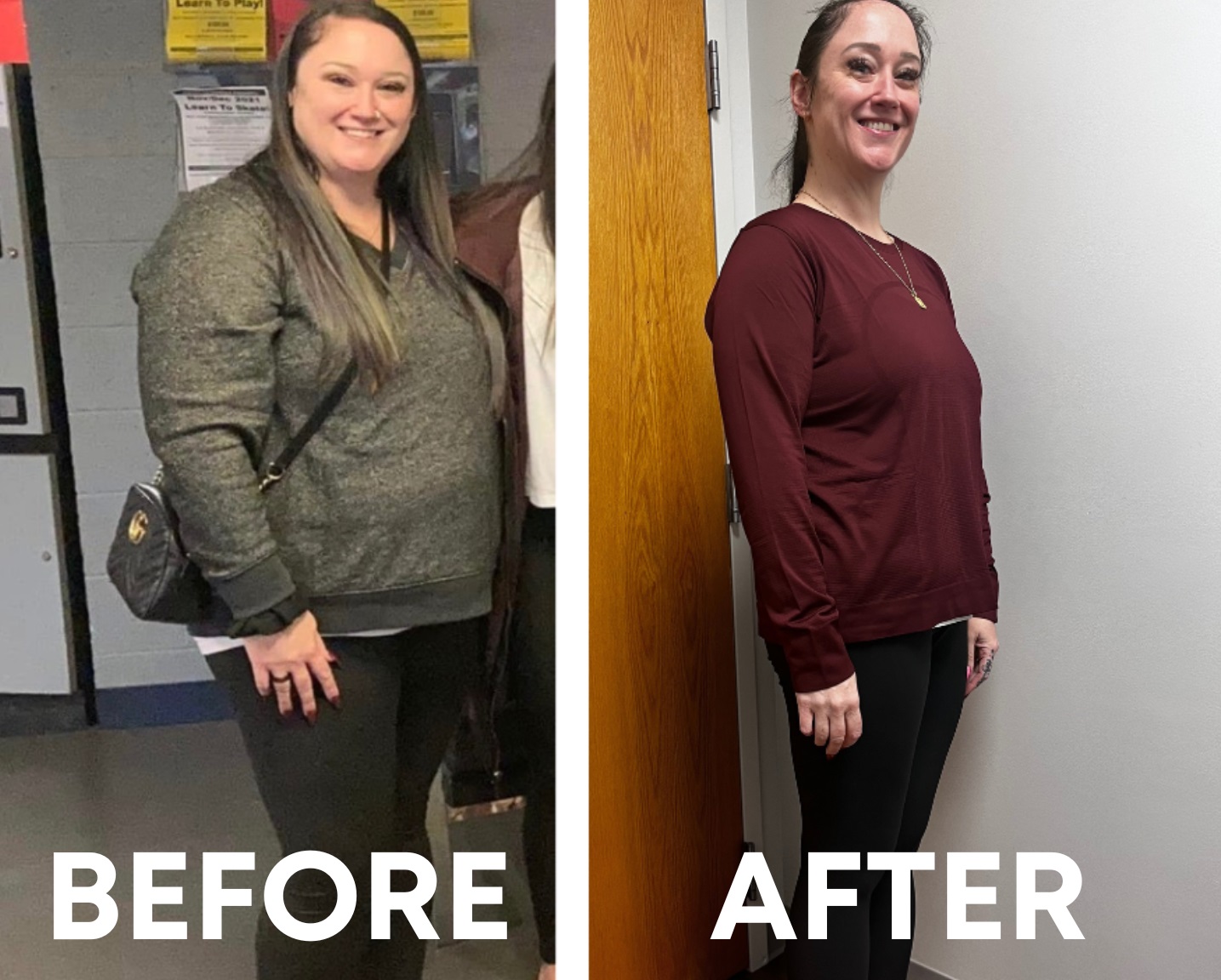Medical weight loss before and after — actual patient at Young Medical Spa