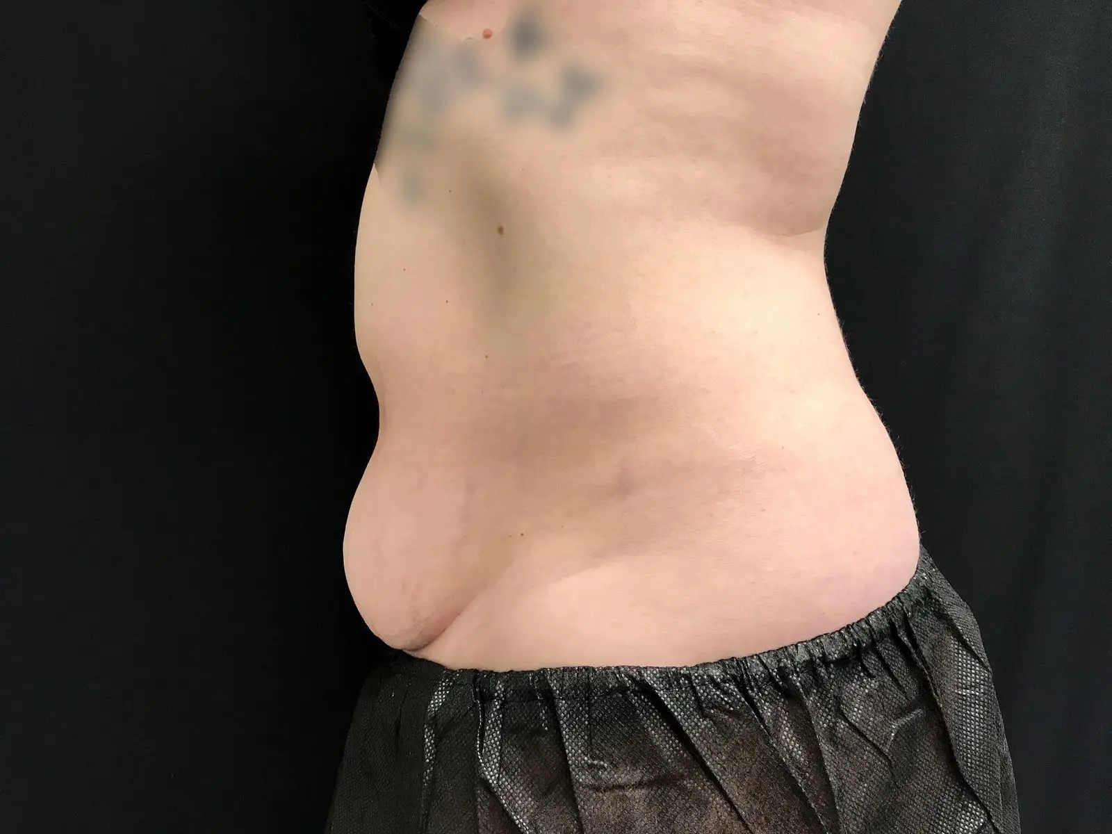 Side view of a person's torso showing a slight abdominal protrusion, with visible skin texture and a tattoo on the upper arm, against a black background. The individual is wearing black mesh shorts, highlighting the midsection for potential health or fitness discussions.