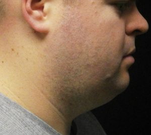 Profile view of a man with short hair and a slight beard, showcasing his jawline and neck. The background is dark, emphasizing the subject's features. The image highlights the contours of his face and neck, contributing to a sense of depth and character. Ideal for discussions on portrait photography, facial structure, or personal branding.
