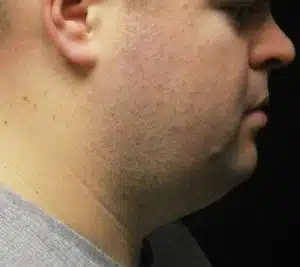Profile view of a man with short hair and a slight beard, showcasing his jawline and neck. The background is dark, emphasizing the subject's features. The image highlights the contours of his face and neck, contributing to a sense of depth and character. Ideal for discussions on portrait photography, facial structure, or personal branding.