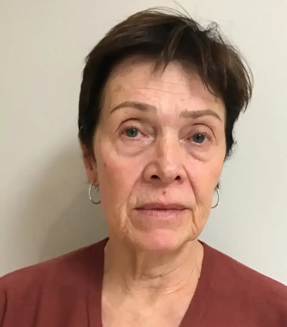 Close-up portrait of an older woman with short dark hair and light skin, wearing a maroon top. She has a neutral expression and is looking directly at the camera. The background is a plain light color, providing contrast to her features. This image is suitable for contexts related to health, wellness, or aging.