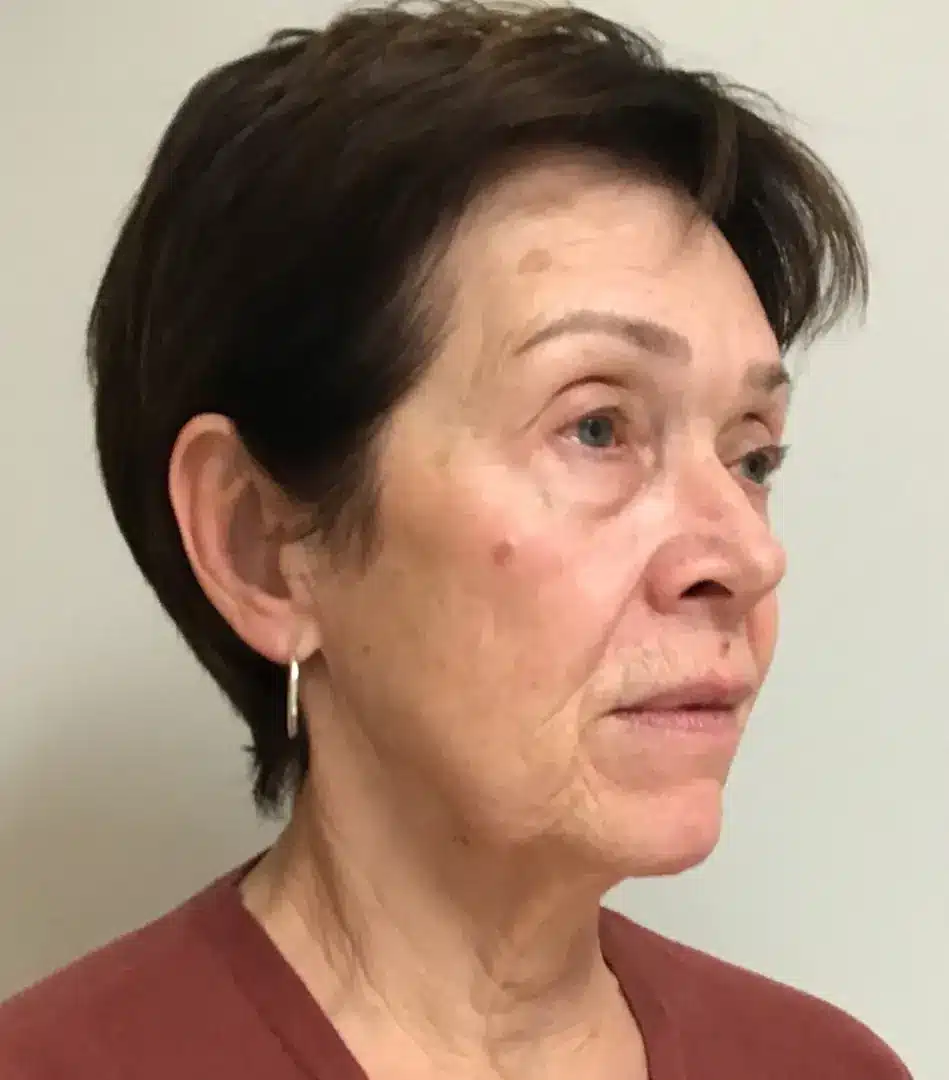 Profile view of a mature woman with short brown hair and hoop earrings, displaying a calm expression. She has visible fine lines and natural skin tones. The background is neutral, emphasizing her features. This image can be used in discussions about aging, beauty, or skincare.